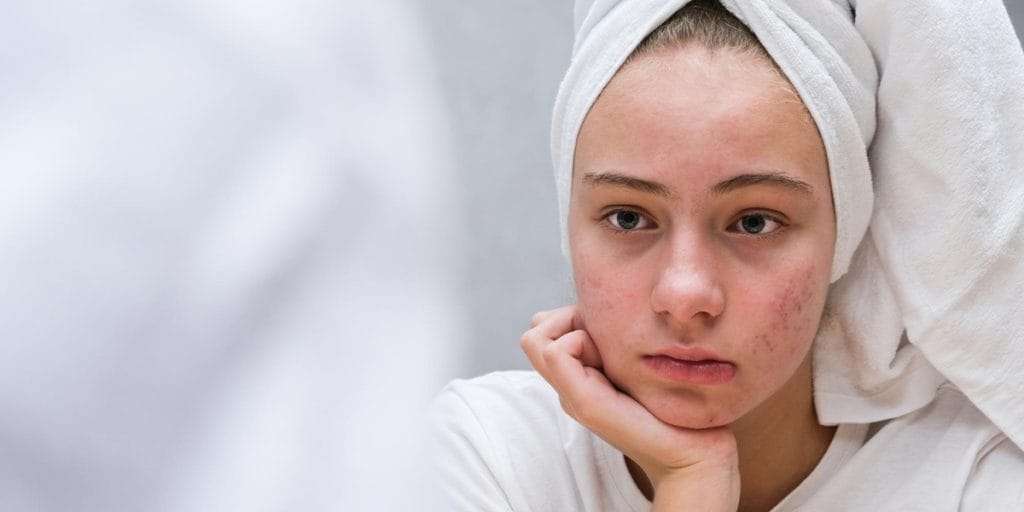facial treatment