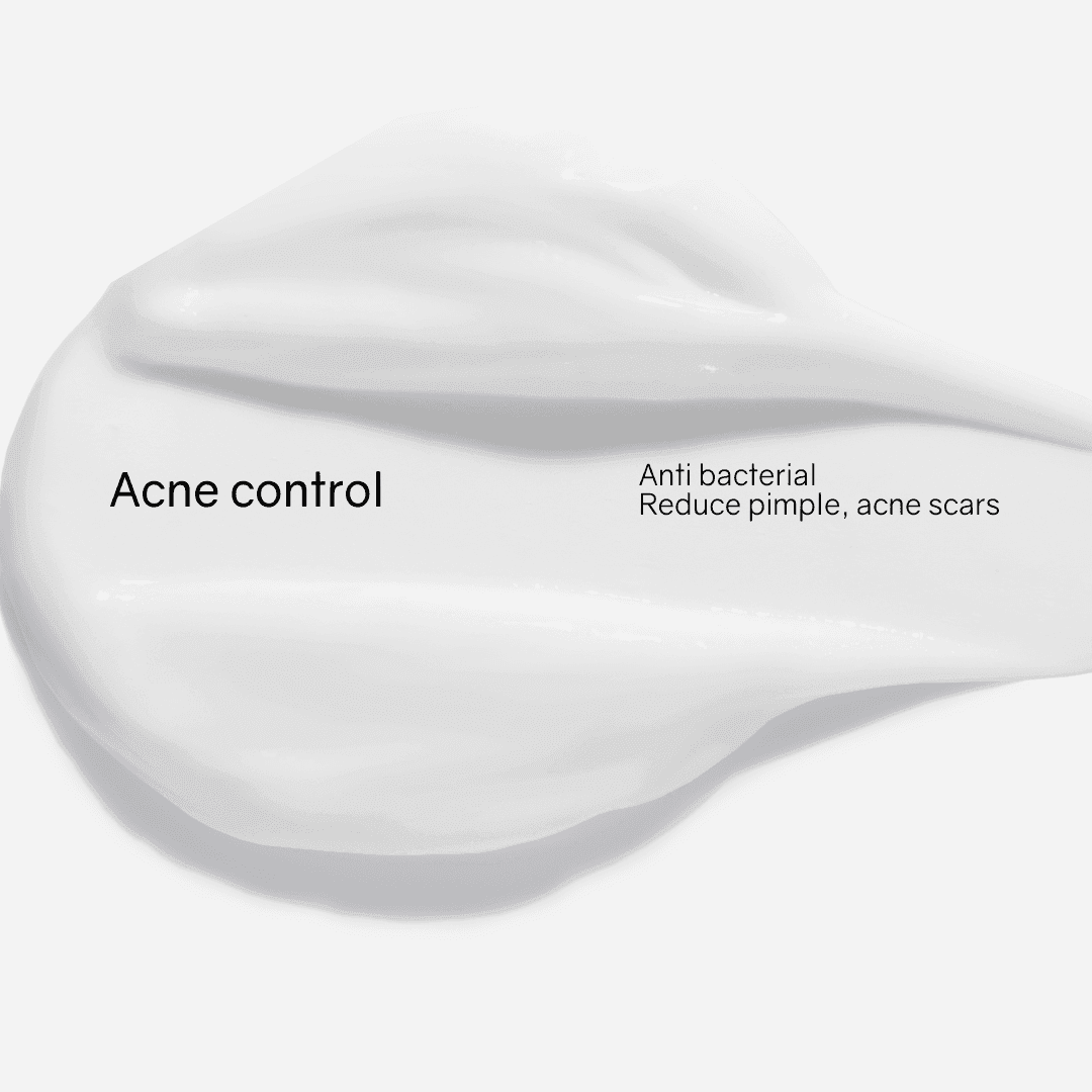 SWI Anti Acne Blemish Essential Treatment Cream for Mattifying & Hydrate - Image 2